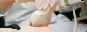 Лечение аневризмы брюшной аорты в Израиле - стент «Талент».